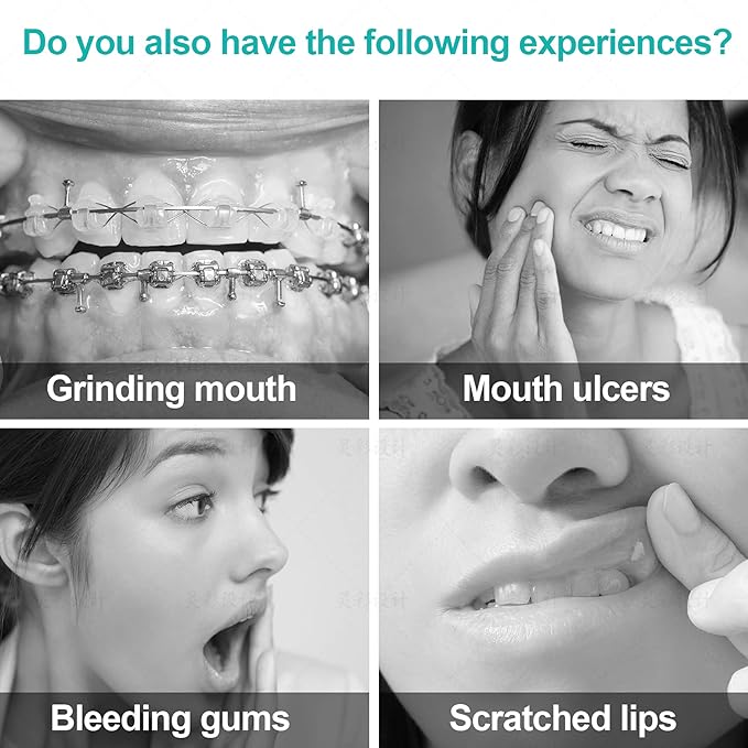 Annhua Braces Wax for Brackets Extra Soft 10 Pack, Dental Orthodontic Ortho Wax Strips with Cutter and Case for Braces Wearer and Aligners, 10 Fruit Smell