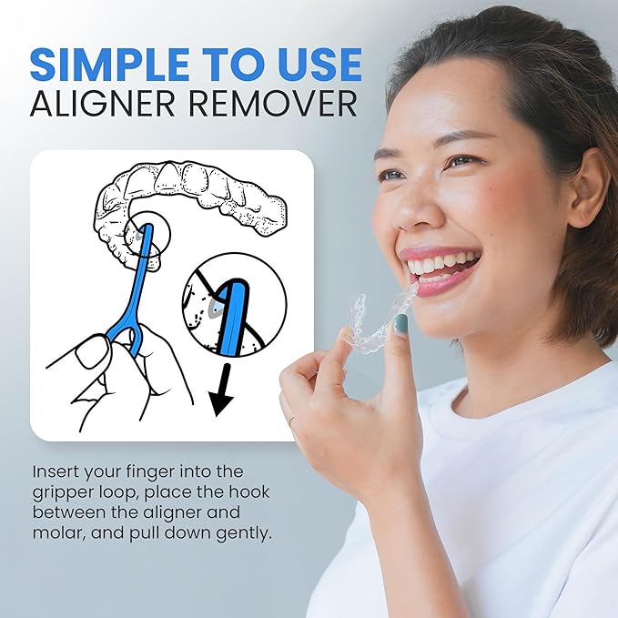 OrthoKey Clear Aligner Removal Tool - Unleash Precision: Grabber Remover for Braces & Retainers | Elevate Dental Care with Ortho Tools for Orthodontic Care | Small Blue, 30-Pack.