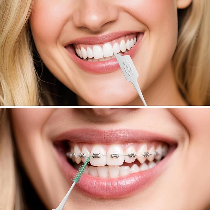 Bopika Soft Interdental Brushes - 300PCS Gentle Dental Picks for Braces, Bridges & Wide Gaps, Dentist-Recommended with Travel-Friendly Case