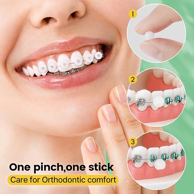 Orthodontic Wax for Braces Wax 120 Individual Hygienic Packaging Dental Wax Dots Strawberry