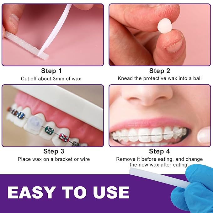 20PCs Dental Grade Orthodontic Wax for Braces & Aligners by OMNIA ONE | Braces Wax for Teeth with Colorful Storage Cases | Food Grade Ortho Brace Wax