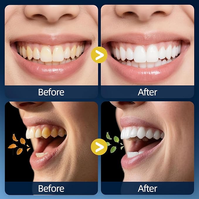 RAZOKO Mouthwash Travel Size-Portable Fresh Mint Packets,Alcohol & Fluoride Free Mouthwash,Disposable Oral Care Strips (0.41 Fl Oz (Pack of 20), Coconut)