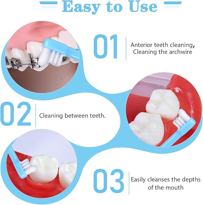 2Pcs End Tuft Toothbrush, Soft Wisdom Toothbrush for Adult, End Tapered Orthodontic Tooth Brush for Periodontal, Interdental Interspace, Dental Detail Cleaning (Blue White)