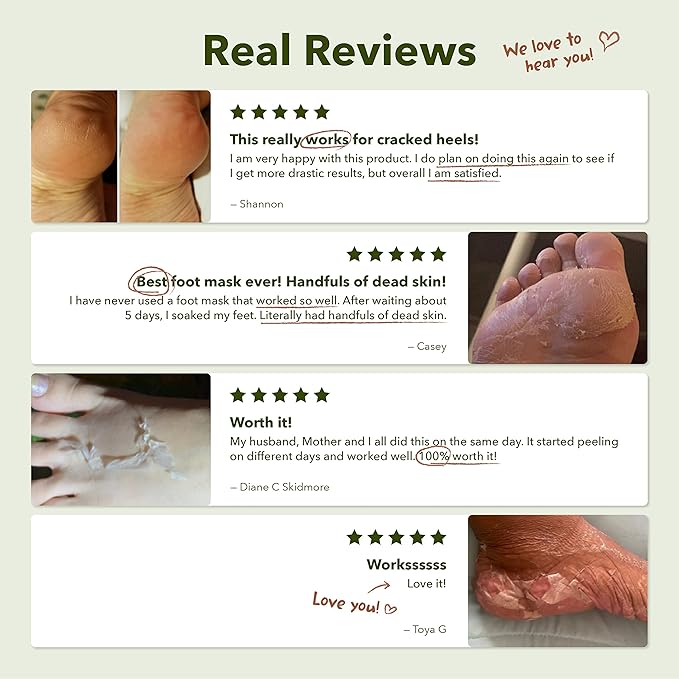 Purederm Shiny & Soft Foot Peeling Mask (6 pack) - For smooth and moist baby skin with Exfoliating peel off Calluses, Dry Skin, Cracked Heels - Men and Women-StrideForce Fitness