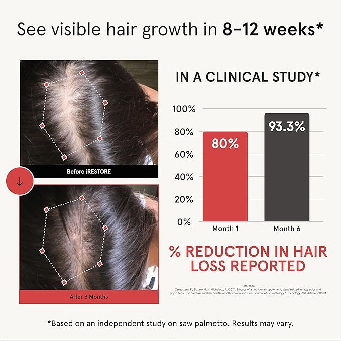 iRestore Hair Growth Supplement - Hair Loss Vitamins for Women and Men - Biotin Multivitamins & DHT Blocker to Reduce Hair Thinning - Hair Regrowth Pills - 30 Days Supply 90 Count (Pack of 1)-StrideForce Fitness