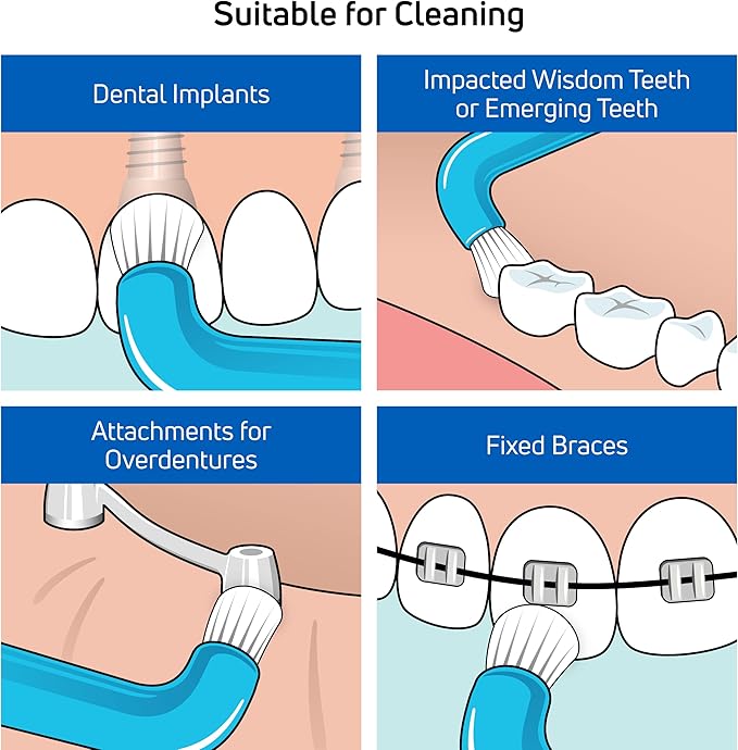 TEPE Compact Tuft Toothbrush, Tufted Brush End Orthodontic Toothbrush for Braces, Dental Implants, Denture Brush, Small Head, 1 Pk