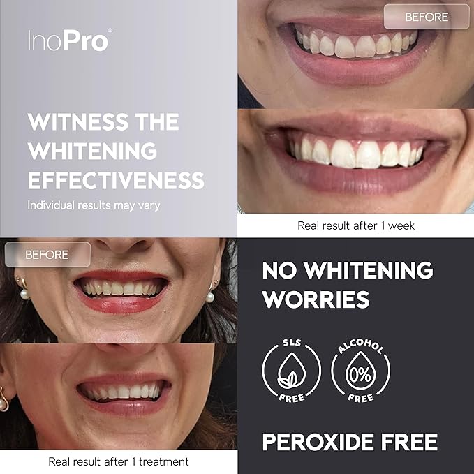 InoPro Natural Teeth Whitening Strips Kit 14 Treatments - Sensitive Teeth Whitener, Peroxide Free with Papain, Bromelain, Coconut Oil, White Strips for Teeth Whitening (28 Strips)