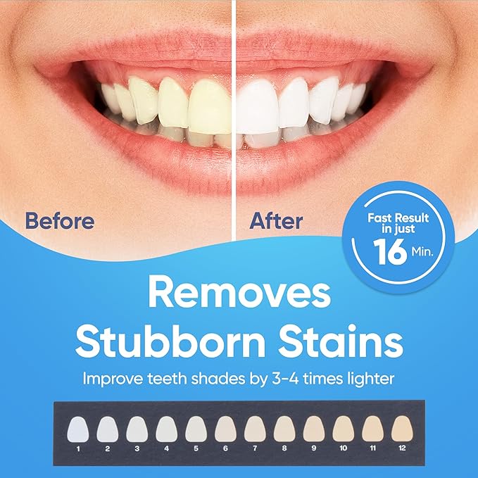 LED Teeth Whitening Kit with 4 Gel Syringes & Case | Formulated by Dentists | Professional Tooth Whitening for Sensitive Teeth | Enamel-Safe and Clinically Tested