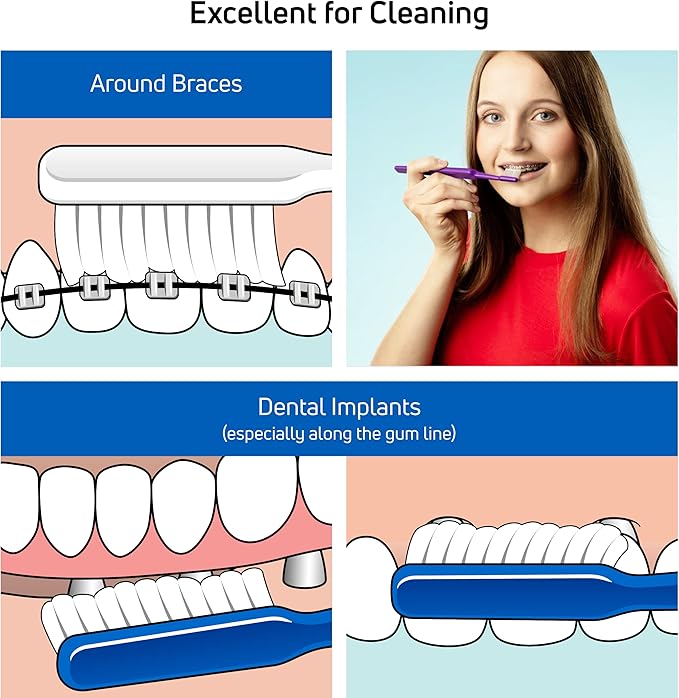 TePe Implant Orthodontic Soft Toothbrush – Extra Narrow Brush Head Thin Neck 1Pk (Pack of 2)