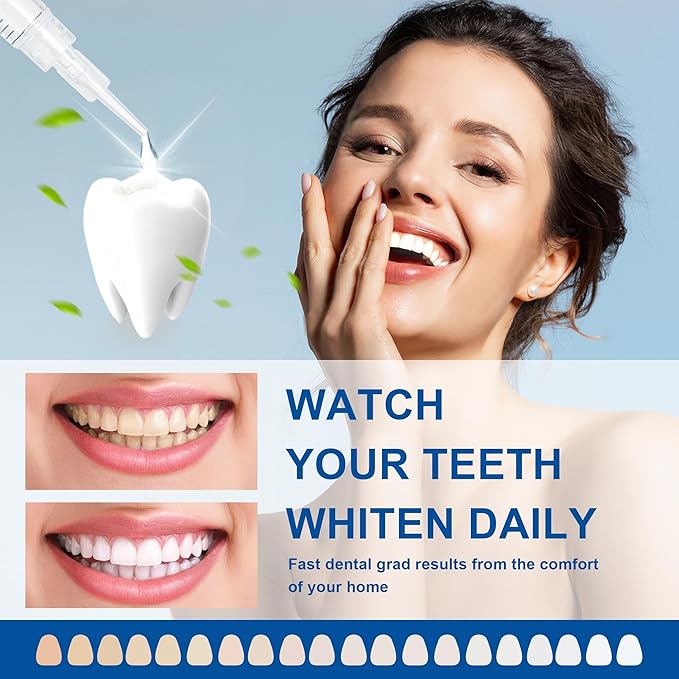 LUCKIN SMILE 10 * 3ML Teeth Whitening Gel Refill, 44% Carbamide Peroxide Suitable for Sensitive Teeth Whitening, 60 Whitening Treatments, Teeth Whiteners Used in Conjunction with Teeth Whitening Kit