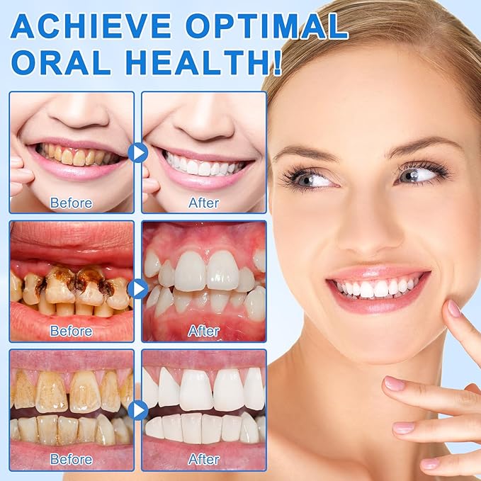 Hydroxyapatite Toothpaste for Enamel Protection and Tooth Strengthening - 9.9% Hidroxiapatita Toothpaste for Sensitive Teeth to Repair, Fluoride-Free Dental Care with Natural Mint (240g)