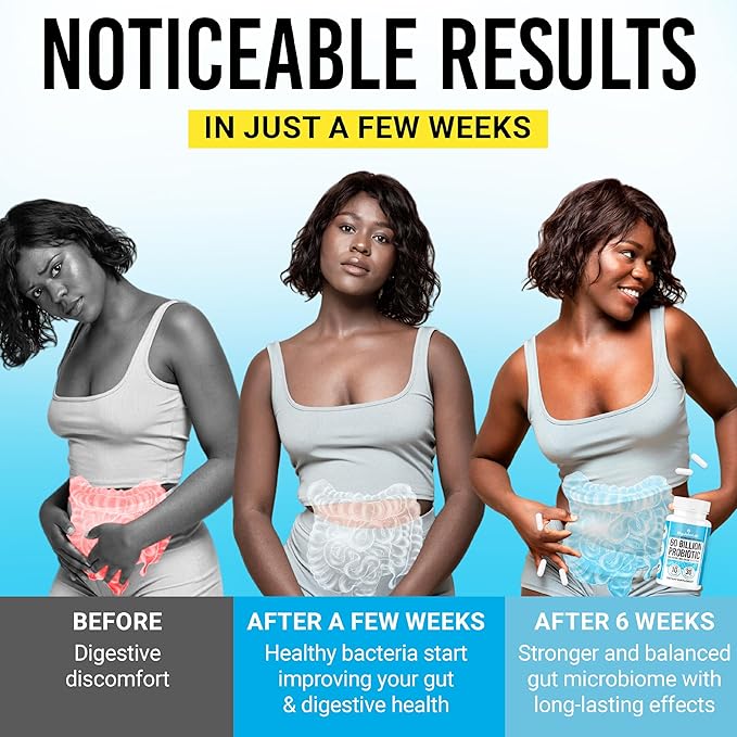 BIGJOHNLAB® Probiotics 60 Billion CFU – 10 Strains + Organic Prebiotics – Immune, Digestive & Gut Health – Supports Occasional Constipation, Diarrhea, Gas & Bloating – for Women & Men – 30ct-StrideForce Fitness