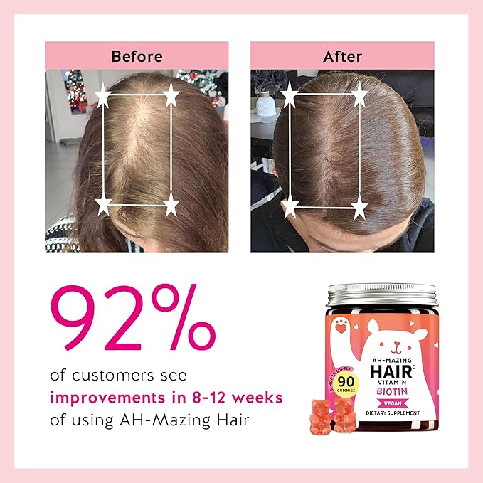 Biotin Gummies for Hair, Skin & Nails. 5,000 mcg High Potency Vegan Vitamins for Faster Hair Growth, Stronger Nails & Healthy Skin. with Vitamins C & E, 30 Gummies-StrideForce Fitness