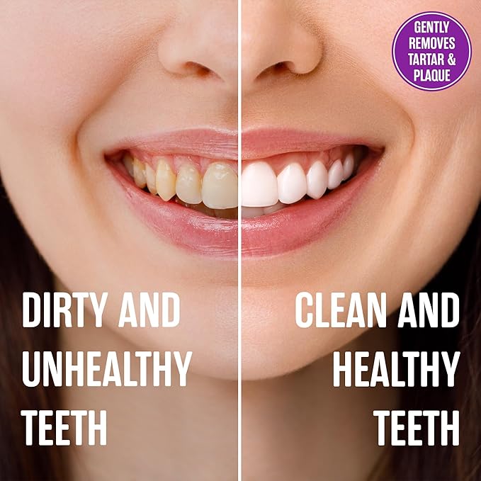 SprinJene Natural Sensitivity & Gum, Fluoride Toothpaste for Sensitive Teeth | Natural Toothpaste for Cavity Protection | 2 Pack