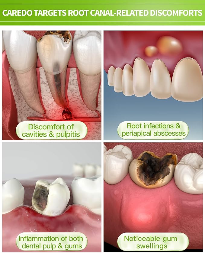 Toothpaste Gum Repair for Avoid Root Canal Therapy, Gingivitis Treatment for Pulpitis Discomforts and Tooth Repair, Remineralizing Hydroxyapatite Toothpaste for Root Canal Discomforts, Mint 3.52 OZ