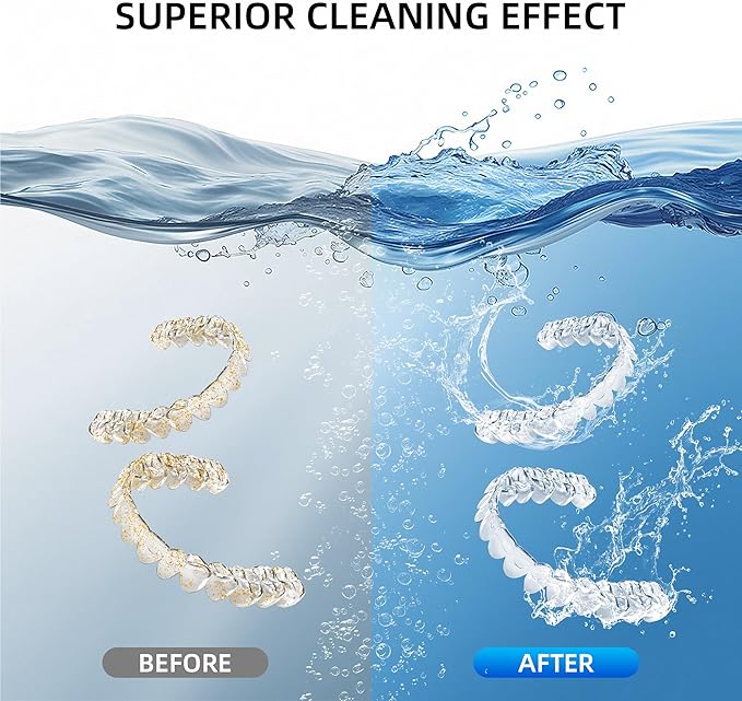 Ultrasonic Retainer Cleaner Machine, 48KHz Dental Cleaning Pod for Denture, Mouth Guard, Aligner, Night Guard, Braces, Toothbrush Heads, Jewelry with Digital Timer & 6 Modes, 13oz Capacity, White
