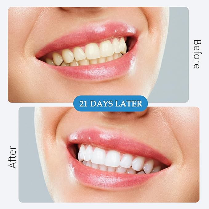 Teeth Whitening Strips - 42 Strips for 21 Day Treatment - Sensitive, Enamel Free & Peroxide Free Tooth Whitener for Whiter Teeth & Stain Removal - Dentist Formulated